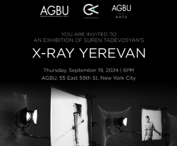 Suren Tadevosyan's X-Ray Yerevan